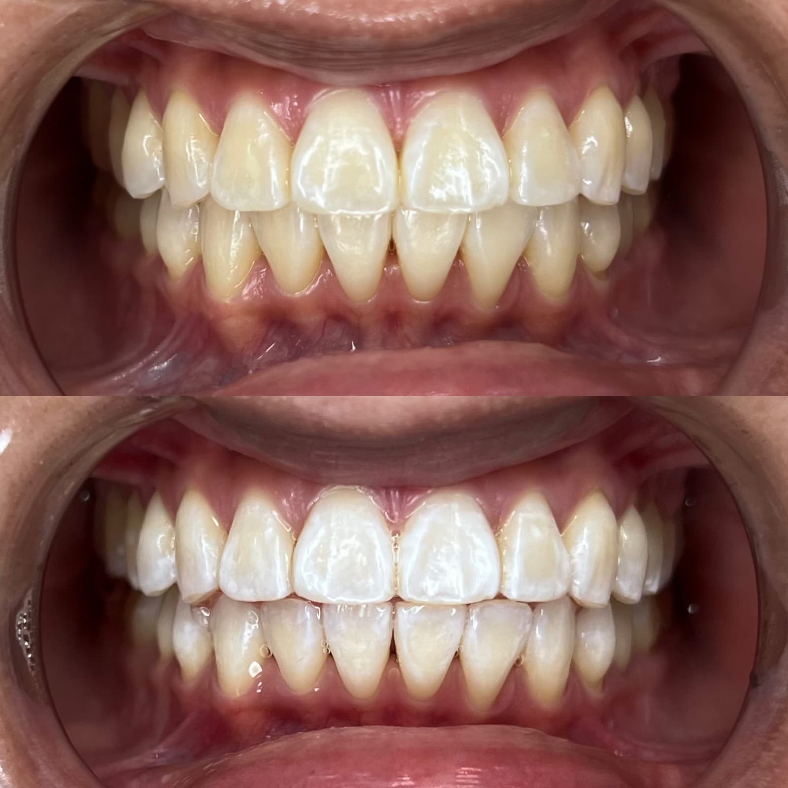 Deep Stain Lift — before