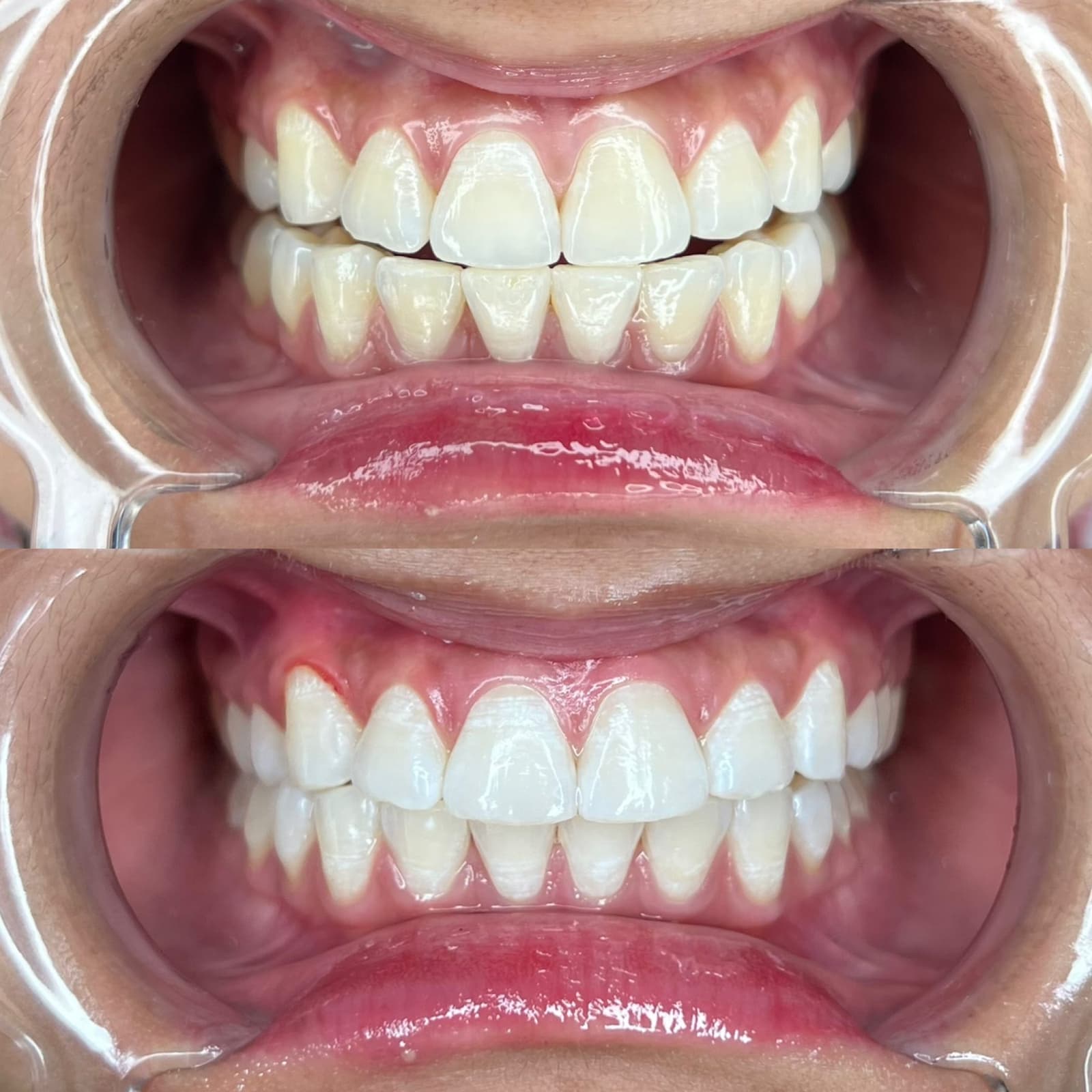 Deep Stain Lift — before